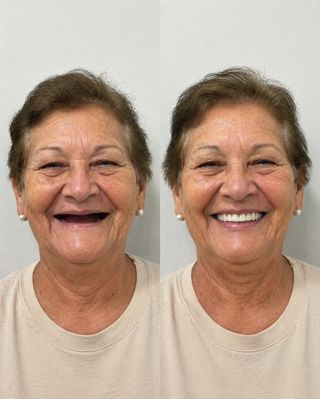 Transformação de paciente — sorriso planejado