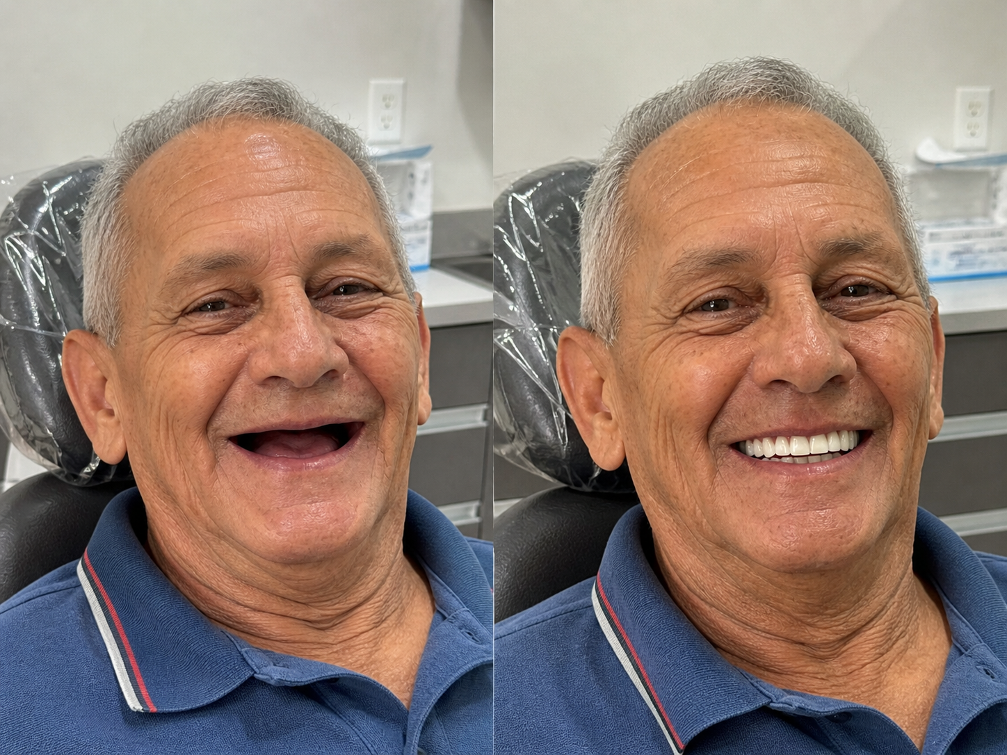 Transformação de paciente — sorriso planejado